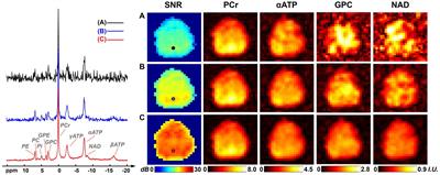 Mapping intracellular NAD content in entire human brain using phosphorus-31 MR spectroscopic imaging at 7 Tesla